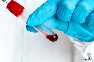 Doctor in blue gloves keep in hands test tube with a blood and syringe