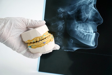 .diagnostics in the course of orthodontic treatment