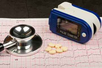 Electrocardiogram