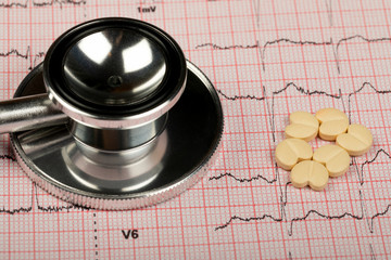 Electrocardiogram
