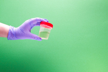 hand in a disposable medical glove holds a jar for analysis with urine, green background, copy space