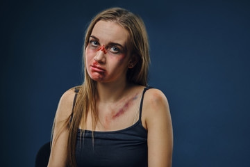 Grieved blonde girl in black t-shirt. Bleeding face covered with bruises, looking at the camera, sitting against blue background. Close-up