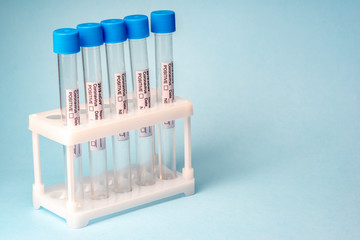 Medical test tubes for coronavirus 2019-nCoV blood tests in holder on a blue background.