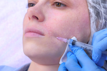 Cosmetologist doctor is making multiple injections biorevitalization with hyaluronic acid in woman face skin on cheek, closeup. Beautician on mesotherapy and face lifting procedure in beauty clinic.