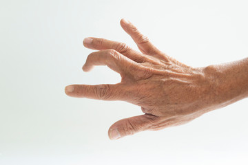 Trigger Finger a defect in a tendon causing a finger to jerk or snap straight when the hand is...