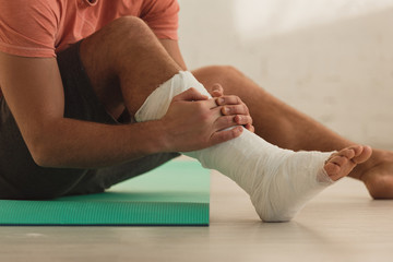 Fototapeta na wymiar Cropped view of man holding broken leg and sitting on fitness mat on floor