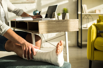 Cropped view of man touching broken leg while using laptop at home - obrazy, fototapety, plakaty