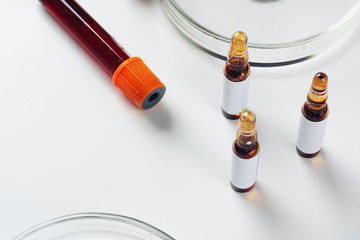 Blood test analysis with Petri dish close up