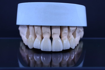 Aesthetic ceramic crown with mirror black background