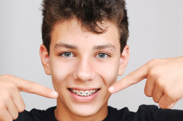 A pretty teenager on a gray background. He points his fingers of both hands on braces on his teeth and smile - obrazy, fototapety, plakaty