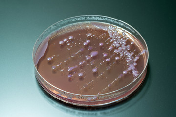 bacterial colonies   on  agar   medium petri dish plate plate on MacConkey agar