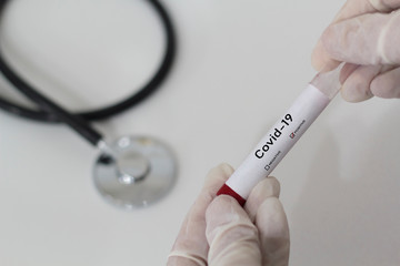 Positive blood test for COVID-19 virus with medical stethoscope on the background