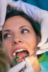 Closeup clean dental examination on a woman's teeth in a dental office