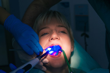 Closeup dental examination with ultraviolet light on a female patient in the office of the dentist