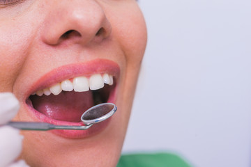 Closeup of a female patient with an open mouth during oral checkup at the dentist.