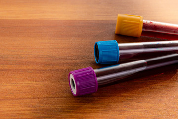 Blood test tubes on wooden table. Top view, copy space.