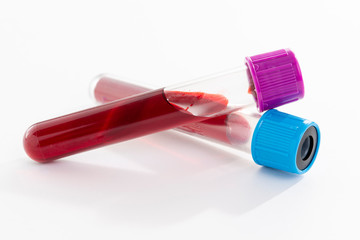 Blood test tube on white background. space for text.