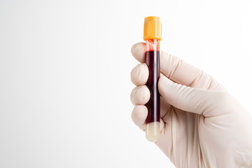 Male nurse presented blood test on white background.