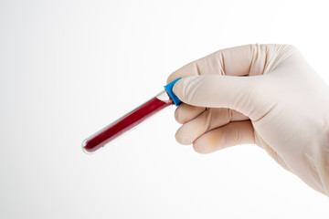 Male nurse holding blood test on white background. Space for text.