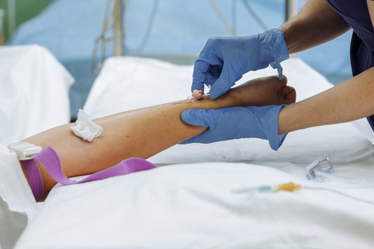 Hands in medical gloves place a catheter in the wrist.