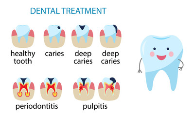 Dental treatment poster. Icon Diseases of teeth. caries, pulpitis, periodontitis. Human tooth in flat style. Vector illustration isolated on white,