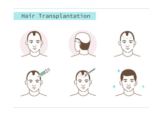 Fototapeta premium Man Character Losing Hair and Receiving Treatment Procedures against Baldness. Prp Injections. Bald Before and After. Hair Transplantation Surgery Concept. Flat Vector Illustration and Icons set.