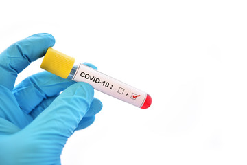 Obraz premium Blood sample tube positive with COVID-19 or novel coronavirus 2019 found in Wuhan, China
