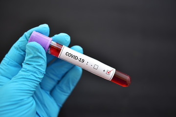 Obraz premium Blood sample tube positive with COVID-19 or novel coronavirus 2019 found in Wuhan, China