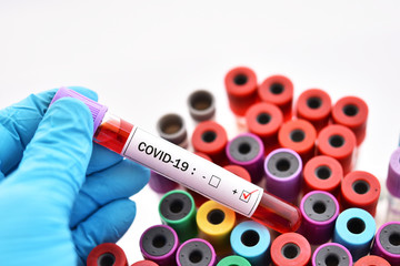 Blood sample tube positive with COVID-19 or novel coronavirus 2019 found in Wuhan, China