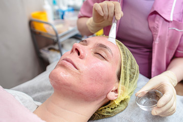 Cosmetologist uses a brush to apply a soothing, transparent mask to the reddened skin of the...