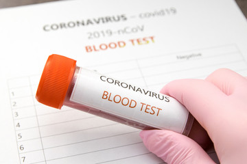 Blood test - Coronavirus, covid19, 2019-nCoV - obrazy, fototapety, plakaty