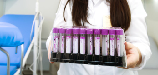 nurse places test tubes on a tray
