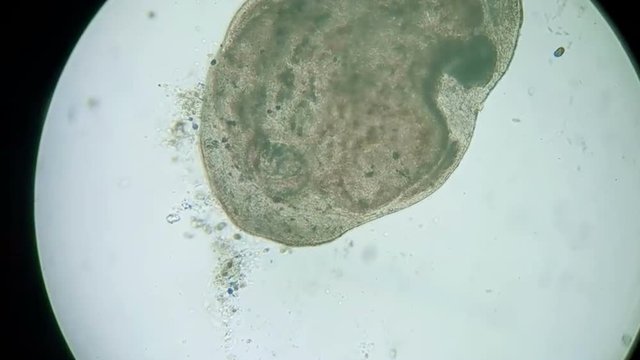 paramecium under a microscope background	