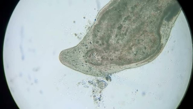 paramecium under a microscope background	