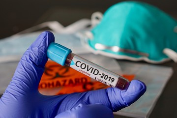 COVID-2019, the name chosen by WHO for the new rapidly spreading Coronavirus outbreak that...