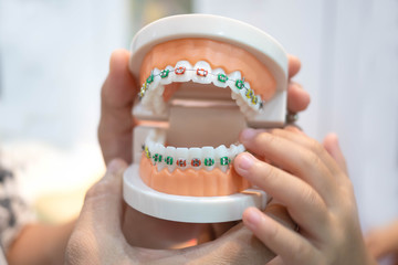 The dentist is holding dentures in hands and shows how the system of braces on teeth is arranged....