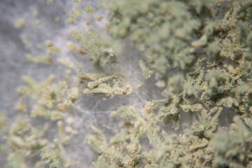 Close up of Aspergillus oryzae is a filamentous fungus, or mold that is used in food production, such as in soybean fermentation for education in laboratory.(soft focus and have Grain/Noise)