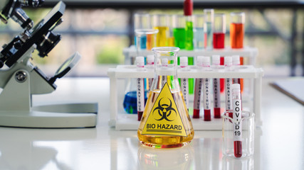 covid-19 infected blood sample in sample tube in laboratory
