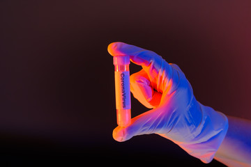 CoronaVirus, 2019-nCOV: Hand hält ein Laborröhrchen