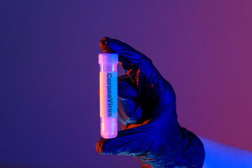 Hand hält Laborröhrchen mit Probe: CoronaVirus, 2019-nCOV