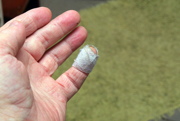 Wounded finger 2