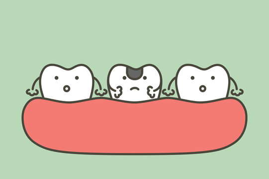 decay tooth or dental caries - teeth cartoon vector flat style