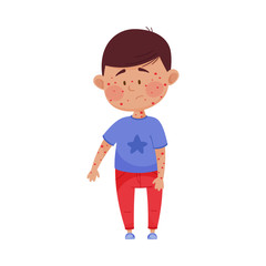 Little Boy Standing with Red Spots on His Skin Vector Illustration