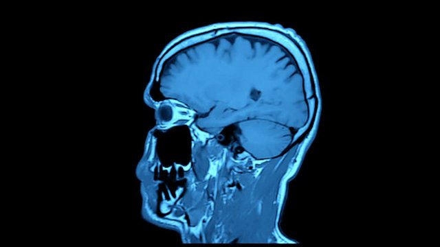 MRI scan. Human brain.
