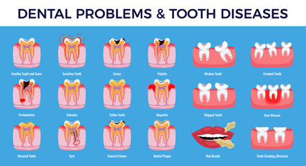 Dental Problems Diseases Infographic Set 