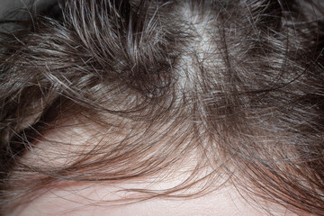 disheveled hair on the girl's head