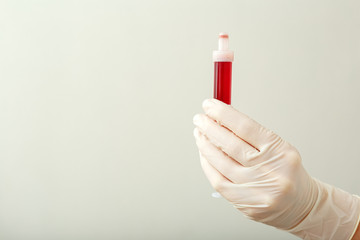 Blood test in tube for laboratory analysis in doctors hand. Laboratory analysis, biochemical blood...