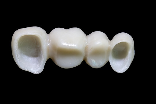 4 units​ zirconia​ bridge​ with​ all porcelain on black background.
