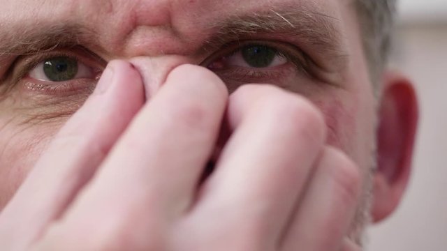 Upset white man examines bruise on bridge of nose. Extreme Close-up