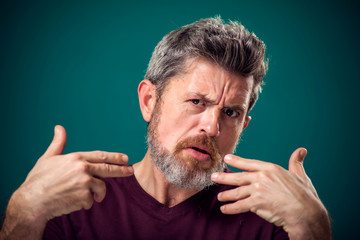 A portrait of bearded surprised man pointing fingers at himself. People and emotions concept